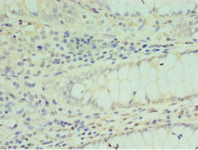 SOX6 Antibody