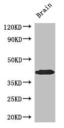 SPDEF Antibody