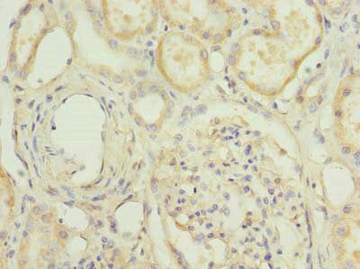 HPCAL1 Antibody