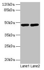 SSB Antibody