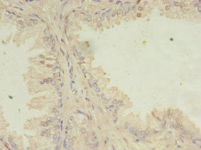 ITPRID2 Antibody
