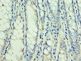 SSNA1 Antibody