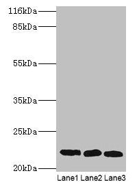 SSSCA1 Antibody