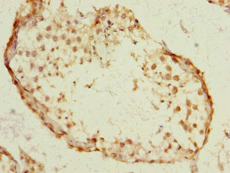 SST Antibody