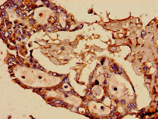 SST Antibody