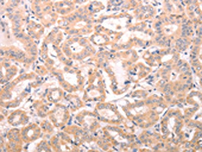 ABHD12 Antibody