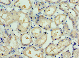 SSX5 Antibody