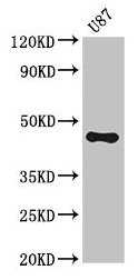 ST8SIA5 Antibody