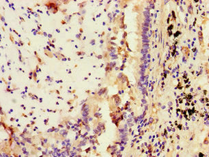 STAT2 Antibody