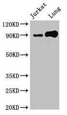 STAT5B Antibody
