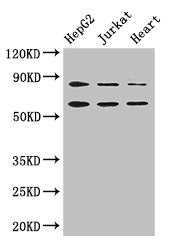 STIM2 Antibody