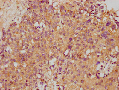 STX10 Antibody