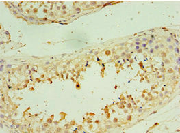 STX16 Antibody