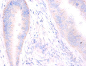 STX6 Antibody