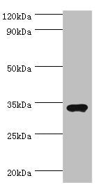 SULT1A3 Antibody