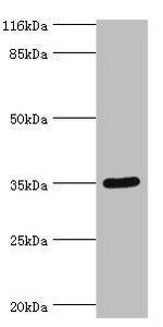 SULT1B1 Antibody