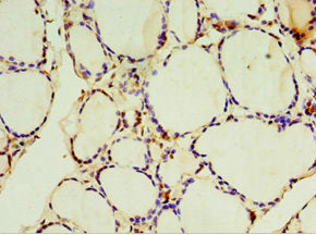 SULT1C2 Antibody