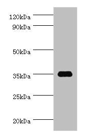 SULT1C2 Antibody