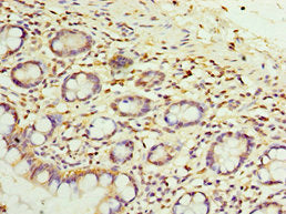 SULT1E1 Antibody