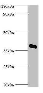 SULT2A1 Antibody