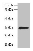 ATP6V1E1 Antibody