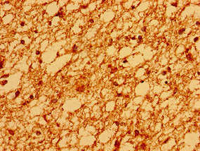 SV2A Antibody