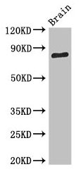 SV2B Antibody