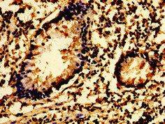 SYK Antibody