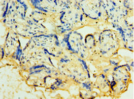 TACSTD2 Antibody