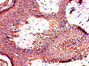 TANK Antibody