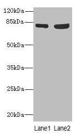 TARS Antibody