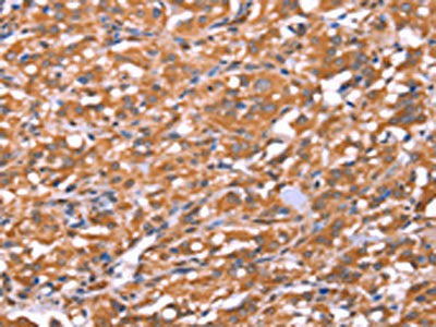 FAM13B Antibody