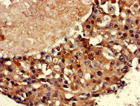 TBP Antibody