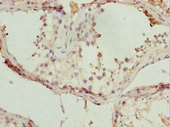 TBPL1 Antibody