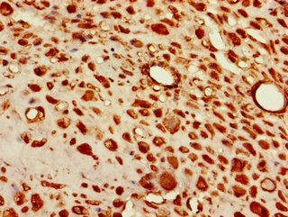 TBX6 Antibody