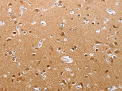 PFN2 Antibody