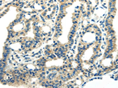 PDPN Antibody