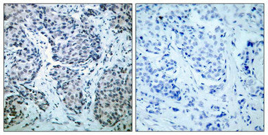 Phospho-MAP2K4 (Thr261) Antibody