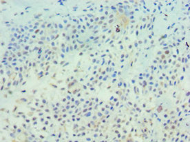 TFF1 Antibody