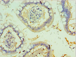 TFF2 Antibody