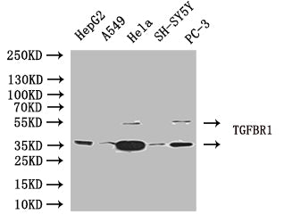 TGFBR1 Antibody