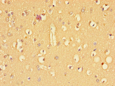 TGFBR2 Antibody
