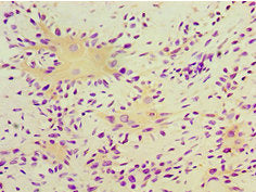 TGM2 Antibody