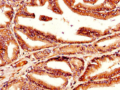 TGM4 Antibody