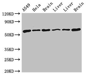 TH Antibody