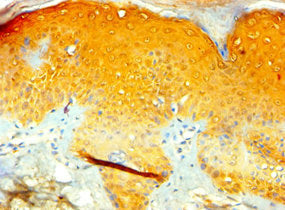 TIAF1 Antibody