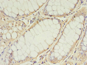 TIMM10 Antibody