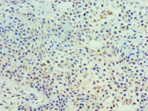 TK1 Antibody