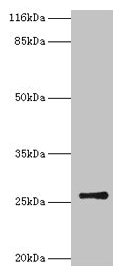 TK1 Antibody
