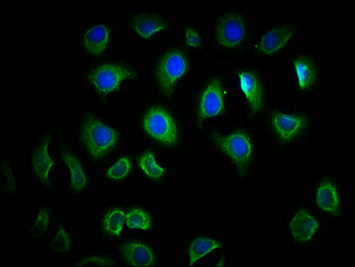 TLR6 Antibody
